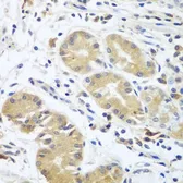 Anti-Complement Factor D antibody used in IHC (Paraffin sections) (IHC-P). GTX33107