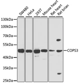 Anti-COPS3 antibody used in Western Blot (WB). GTX33109
