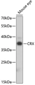 Anti-CORD2 antibody used in Western Blot (WB). GTX33111