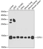 Anti-COTL1 antibody used in Western Blot (WB). GTX33112