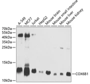 Anti-COX6B1 antibody used in Western Blot (WB). GTX33115