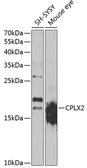 Anti-CPLX2 antibody used in Western Blot (WB). GTX33116