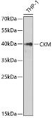 Anti-Creatine kinase (muscle) antibody used in Western Blot (WB). GTX33119