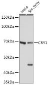 Anti-CRY1 antibody used in Western Blot (WB). GTX33120