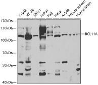 Anti-Ctip1 antibody used in Western Blot (WB). GTX33126