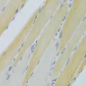 Anti-CXCR3 antibody used in IHC (Paraffin sections) (IHC-P). GTX33131