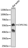 Anti-CYP17A1 antibody used in Western Blot (WB). GTX33134