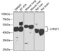 Anti-CYP2F1 antibody used in Western Blot (WB). GTX33136