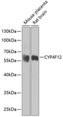 Anti-CYP4F12 antibody used in Western Blot (WB). GTX33137