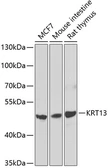Anti-Cytokeratin 13 antibody used in Western Blot (WB). GTX33138
