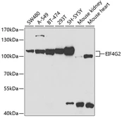 Anti-DAP5 antibody used in Western Blot (WB). GTX33144