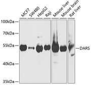 Anti-DARS antibody used in Western Blot (WB). GTX33145