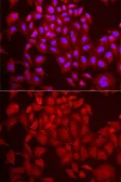 Anti-DCAF7 antibody used in Immunocytochemistry/ Immunofluorescence (ICC/IF). GTX33146