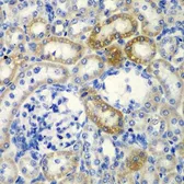 Anti-DCTD antibody used in IHC (Paraffin sections) (IHC-P). GTX33147