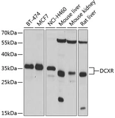 Anti-DCXR antibody used in Western Blot (WB). GTX33148