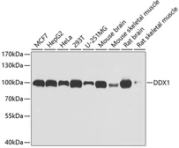 Anti-DDX1 antibody used in Western Blot (WB). GTX33149