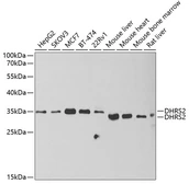 Anti-DHRS2 antibody used in Western Blot (WB). GTX33152