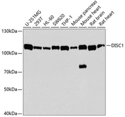 Anti-DISC1 antibody used in Western Blot (WB). GTX33154