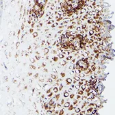 Anti-DLD antibody used in IHC (Paraffin sections) (IHC-P). GTX33155