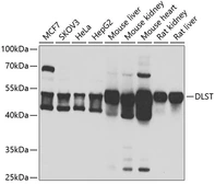 Anti-DLST antibody used in Western Blot (WB). GTX33156