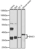Anti-DMC1 antibody used in Western Blot (WB). GTX33157