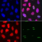 Anti-DNA polymerase epsilon 3 antibody used in Immunocytochemistry/ Immunofluorescence (ICC/IF). GTX33158
