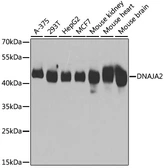 Anti-DNAJA2 antibody used in Western Blot (WB). GTX33159
