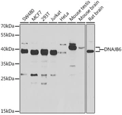 Anti-DNAJB6 antibody used in Western Blot (WB). GTX33160