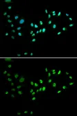 Anti-DNMT3A antibody used in Immunocytochemistry/ Immunofluorescence (ICC/IF). GTX33161