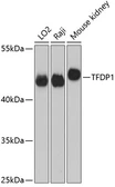 Anti-DP1 antibody used in Western Blot (WB). GTX33162