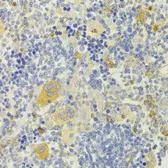Anti-DPP3 antibody used in IHC (Paraffin sections) (IHC-P). GTX33164