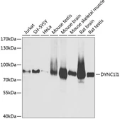 Anti-DYNC1I1 antibody used in Western Blot (WB). GTX33166