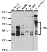 Anti-EED antibody used in Western Blot (WB). GTX33168