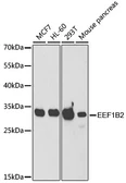 Anti-EEF1B2 antibody used in Western Blot (WB). GTX33169