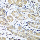 Anti-EIF1A antibody used in IHC (Paraffin sections) (IHC-P). GTX33170
