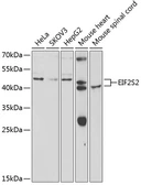 Anti-EIF2 beta antibody used in Western Blot (WB). GTX33171