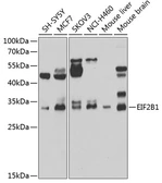 Anti-EIF2B1 antibody used in Western Blot (WB). GTX33172
