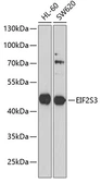 Anti-EIF2S3 antibody used in Western Blot (WB). GTX33173