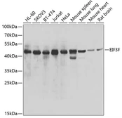 Anti-EIF3F antibody used in Western Blot (WB). GTX33174
