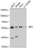 Anti-EIF5 antibody used in Western Blot (WB). GTX33176