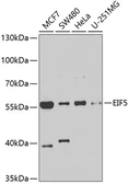 Anti-EIF5 antibody used in Western Blot (WB). GTX33176