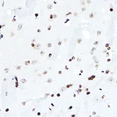 Anti-ELF5 antibody used in IHC (Paraffin sections) (IHC-P). GTX33178