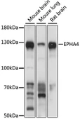Anti-EphA4 antibody used in Western Blot (WB). GTX33182