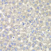 Anti-EYA3 antibody used in IHC (Paraffin sections) (IHC-P). GTX33187