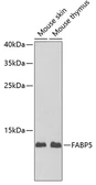 Anti-FABP5 antibody used in Western Blot (WB). GTX33191