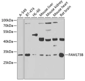 Anti-FAM173B antibody used in Western Blot (WB). GTX33192