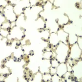 Anti-FBXW11 antibody used in IHC (Paraffin sections) (IHC-P). GTX33193