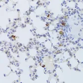 Anti-FCN1 antibody used in IHC (Paraffin sections) (IHC-P). GTX33195