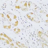 Anti-Ferredoxin Reductase antibody used in IHC (Paraffin sections) (IHC-P). GTX33197