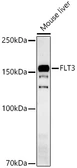 Anti-FLT3 antibody used in Western Blot (WB). GTX33202